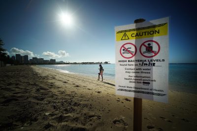 Beach Day? Avoid The Spots With High Bacteria Levels 
