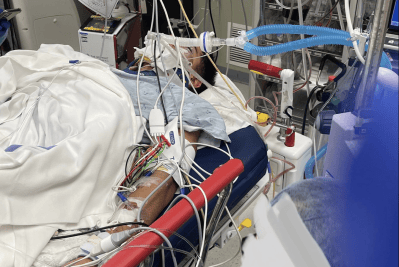 Family Of Paralyzed Teen Sues Police, Alleging Injuries Resulted From High-Speed Chase