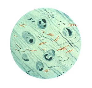 A microscopic photo of Mycobacterium tuberculosis bacteria, the pathogen behind the TB disease.