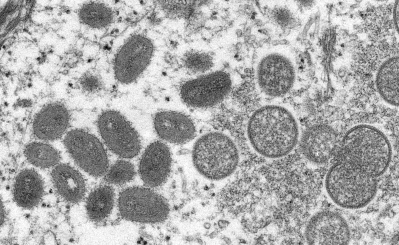 Hawaii Expands Access To Monkeypox Vaccine As Case Count Rises To 16
