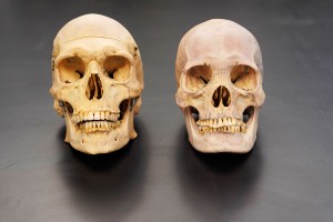Forensic anthropologist Dr. Robert Mann, Professor of Anatomy and Pathology at the University of Hawaii John A. Burns School of Medicine sets out two skulls for comparison Tuesday, July 30, 2024, in Honolulu. The skulls are a white male, left, and a Korean female. They are photographed in the JABSOM Bone Lab. (Kevin Fujii/Civil Beat/2024)