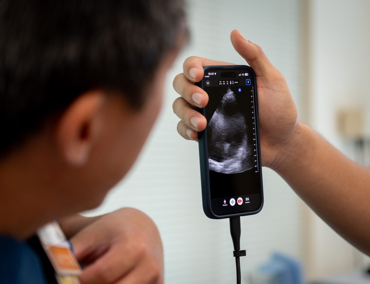A smartphone with an attached cable is held in a hand as an out-of-focus individual looks at the phone at left. The phone shows a grainy ultrasound image.